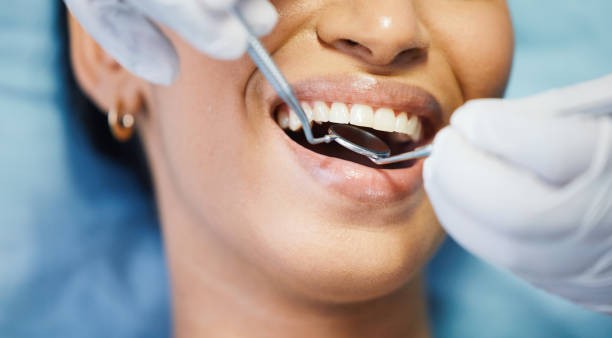 Best Emergency Tooth Extraction in Juneau, AK